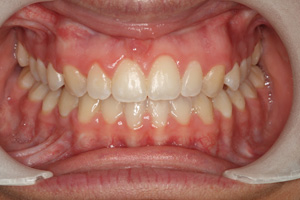 Ortho Perfection Orthodontistes