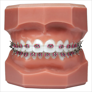 Ortho Perfection Orthodontistes